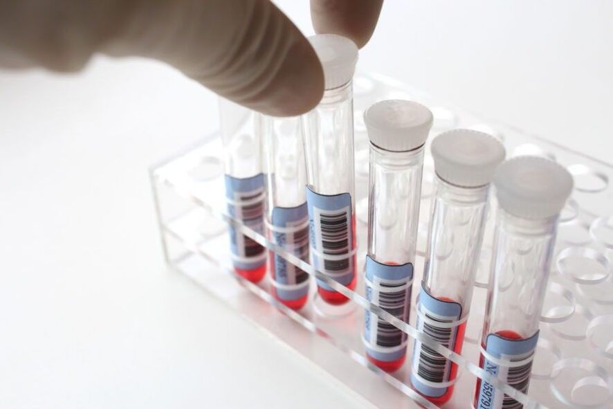 paraziták diagnosztizálása a szervezetben