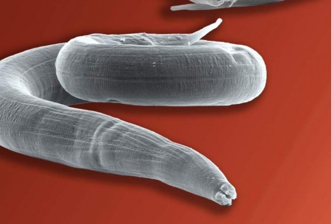 pinworm az emberi testből