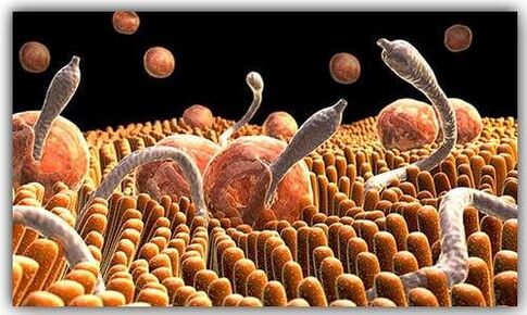 paraziták a testben